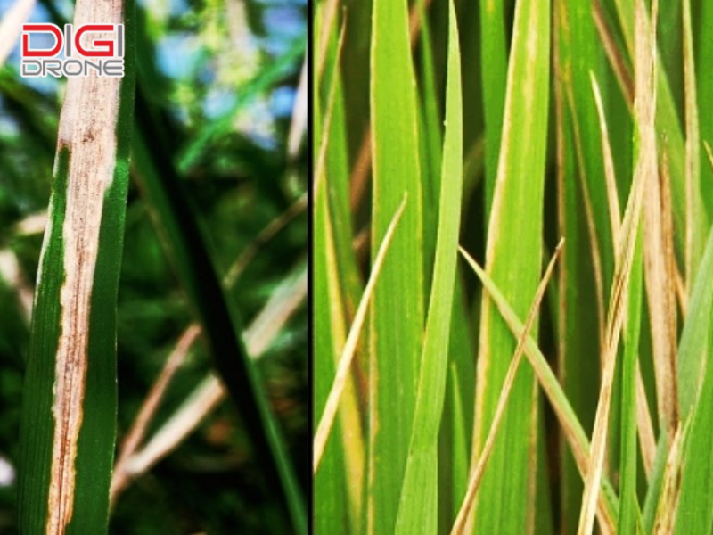 Nguyên nhân và các yếu tố ảnh hưởng đến bệnh